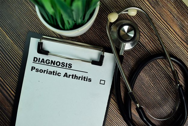 Diagnosis - Psoriatic Arthritis write on a paperwork