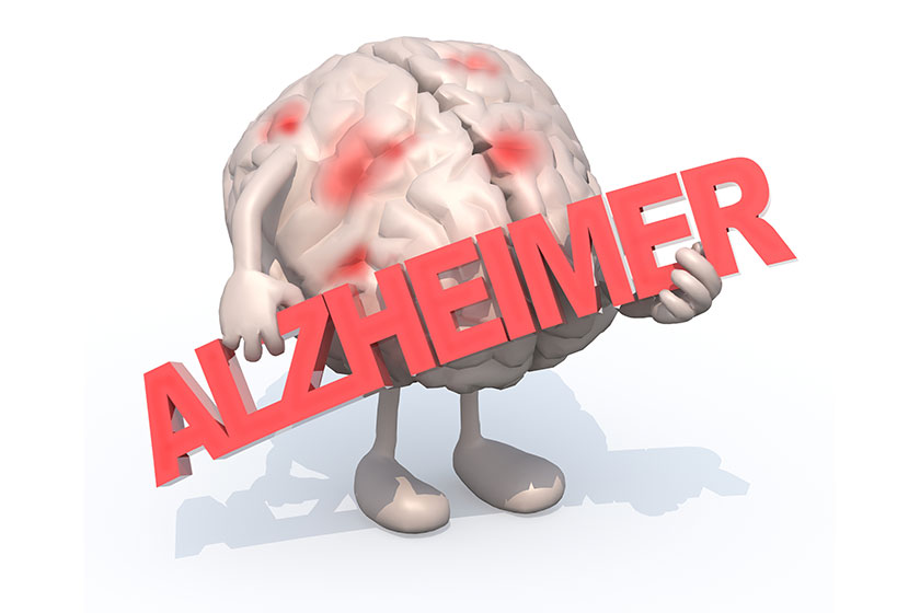 Brain with arts that embraces a word “alzheimer” Brain with arts that embraces a word "alzheimer"