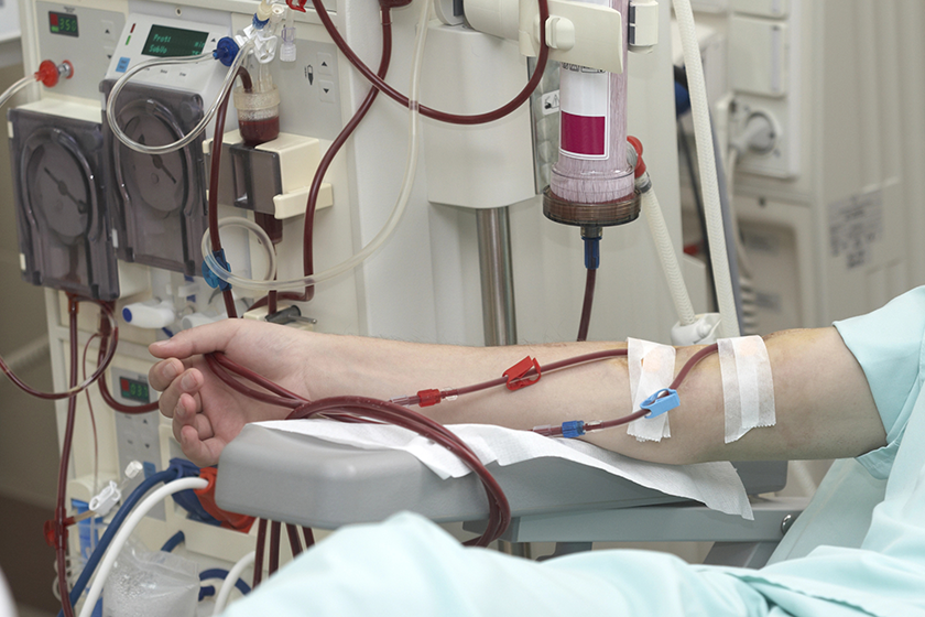 dialysis health care medicine kidney