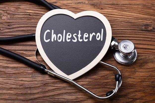 Stethoscope And Heart With Word Cholesterol