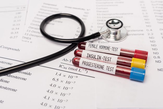 Close view test tubes hormone insulin tests blood stethoscope lists