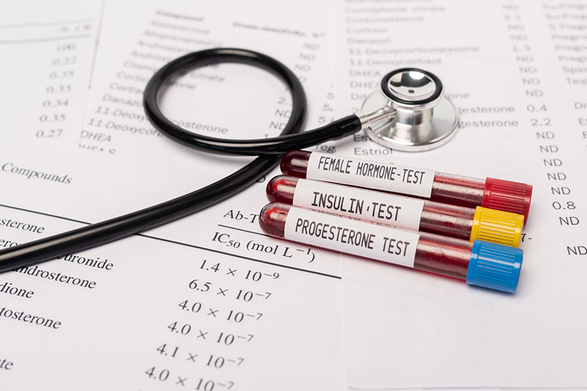 Close view test tubes hormone insulin tests blood stethoscope lists