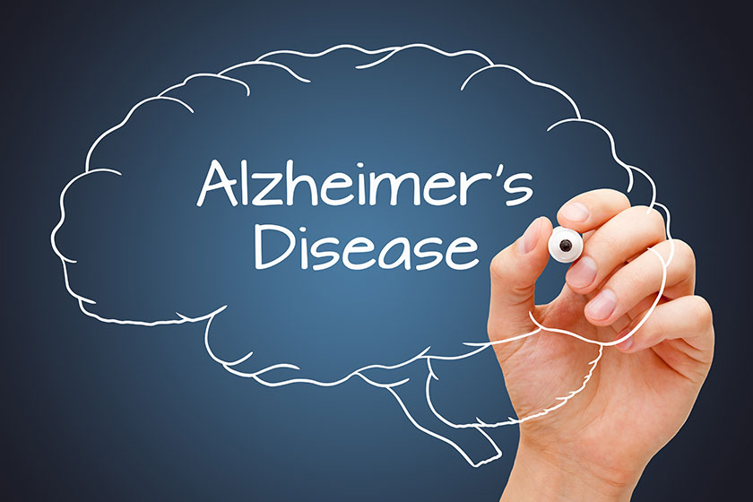 Hand writing alzheimers disease drawn human brain white marker dark Hand writing alzheimers disease drawn human brain white marker dark