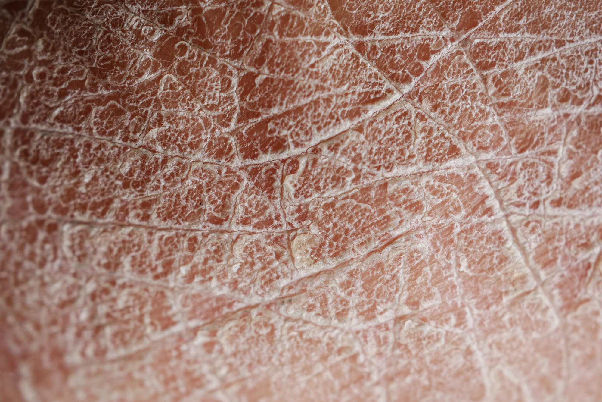 Closeup view of dry human skin .